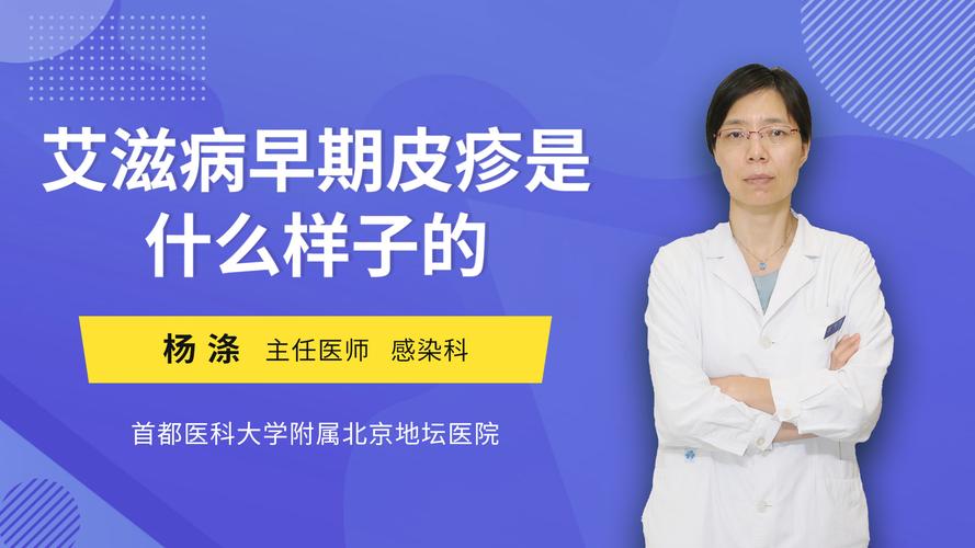 aids是什么的简称