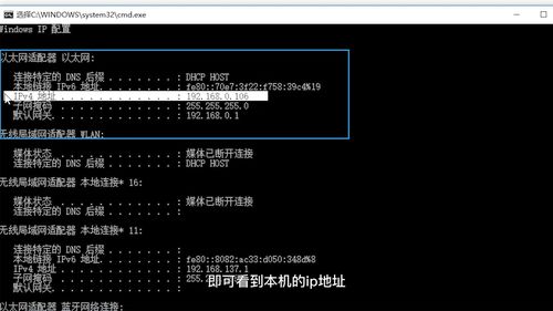 电脑自动获取ip地址在哪里设置