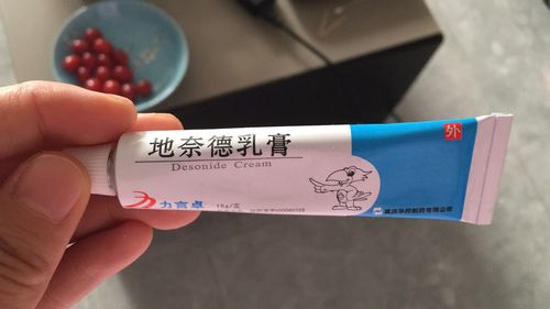 湿疹用什么药膏