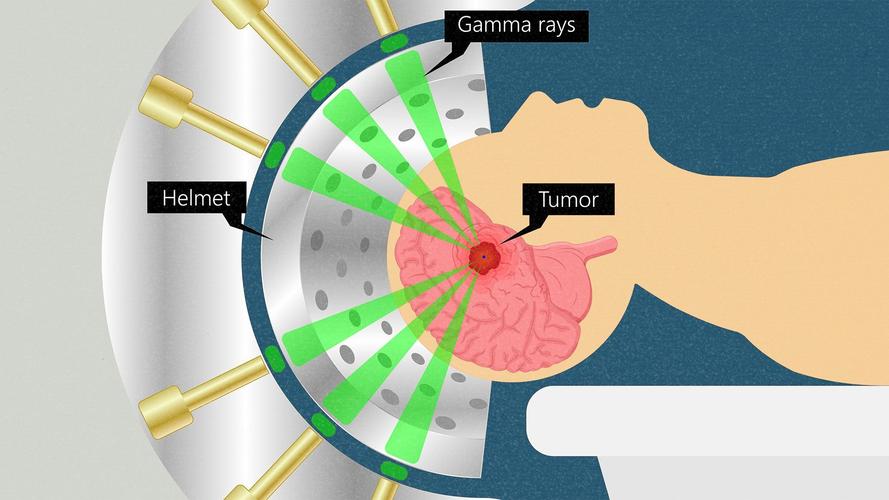 cancer是什么意思啊