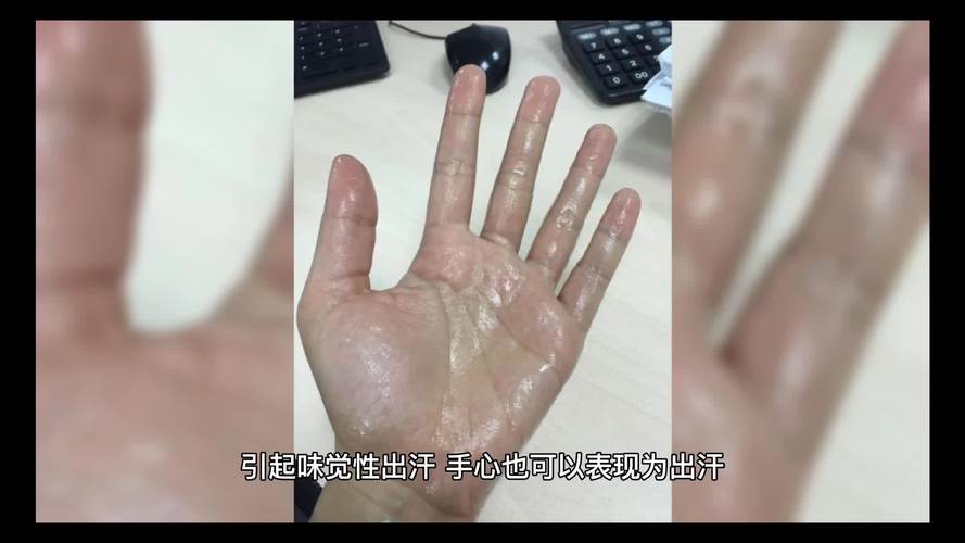 手心经常出汗是什么原因