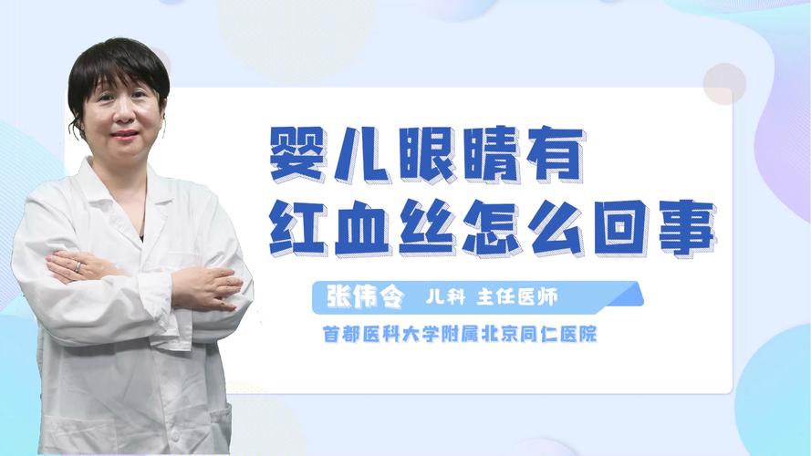 眼睛有血丝是什么原因