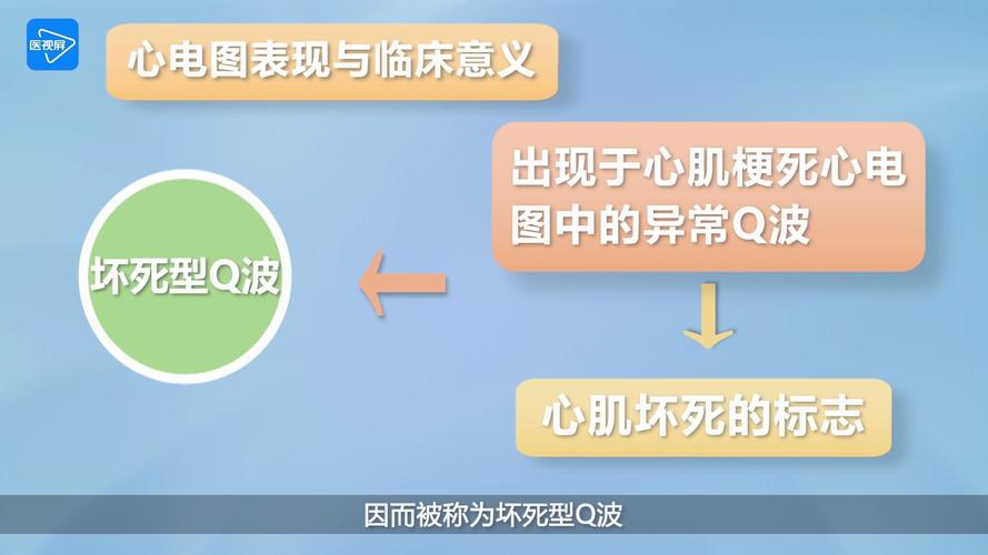 心电图q波是什么意思