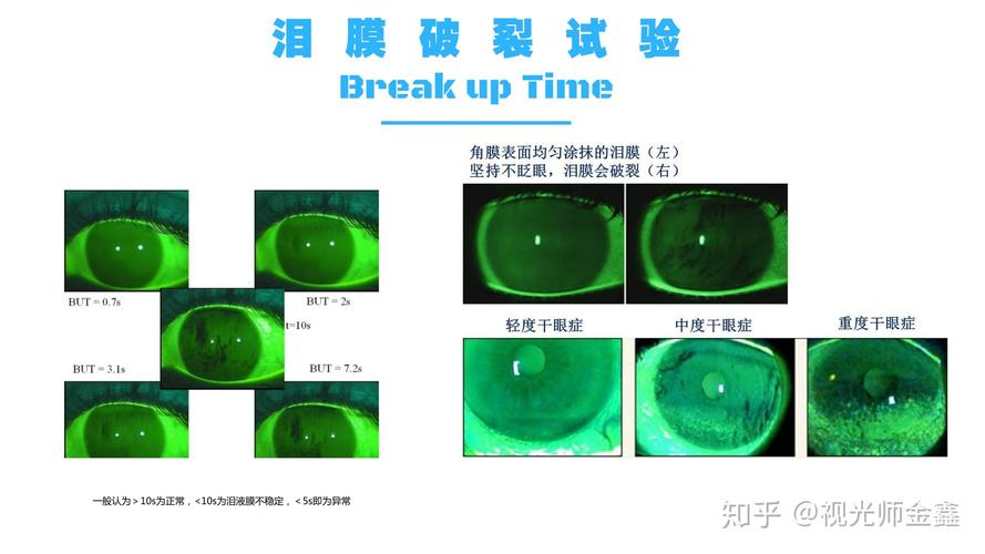 裂开是啥意思