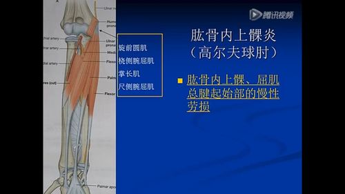 胳膊肘是哪个位置