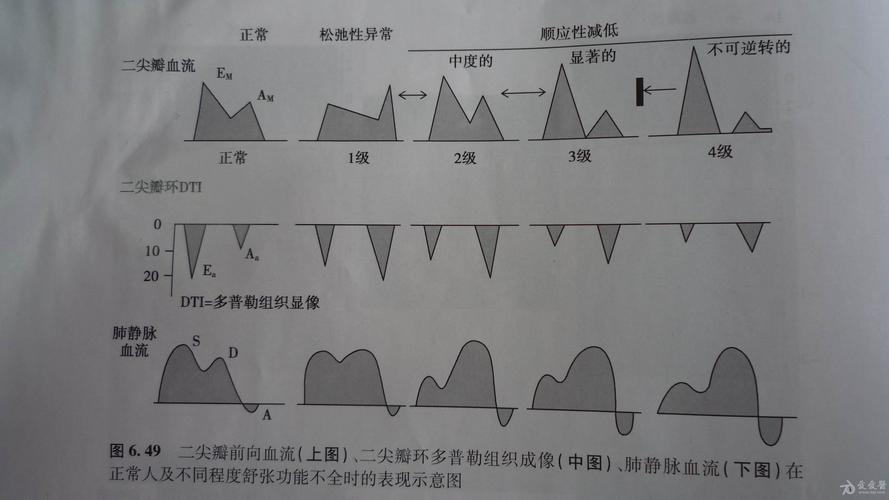 tdi是什么意思