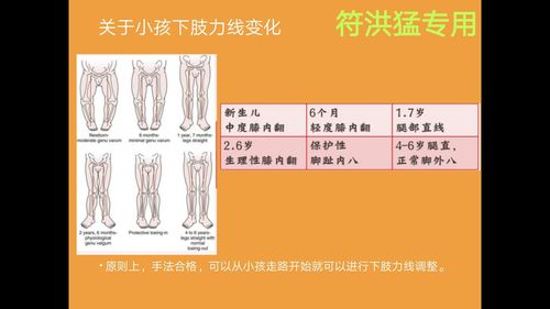 如何使o型腿变直